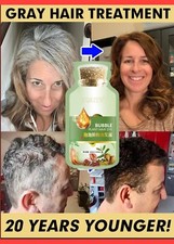 #1 BEST NATURAL HERBAL HAIR