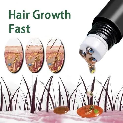 20ml anti hair loss - anti,