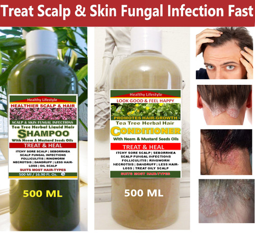 Best remedy for seborrhea - best,
